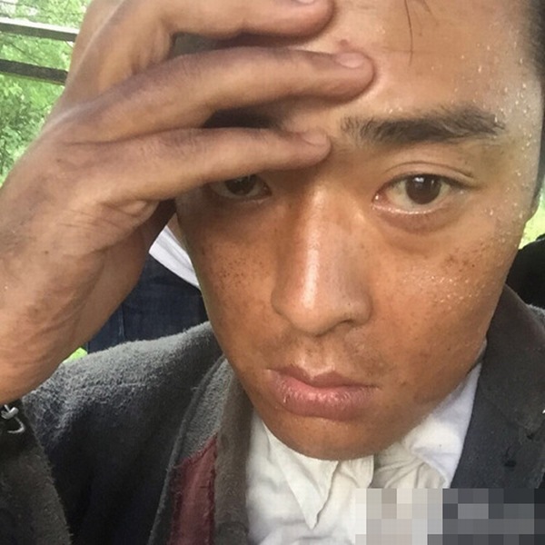 张桐暴瘦原因成谜